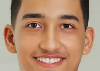 Joven de Sosúa queda sin signos tras incidente vial