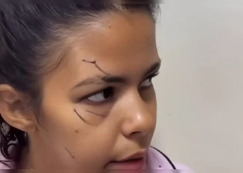 Joven denuncia falta de auxilio tras suceso familiar en Santiago